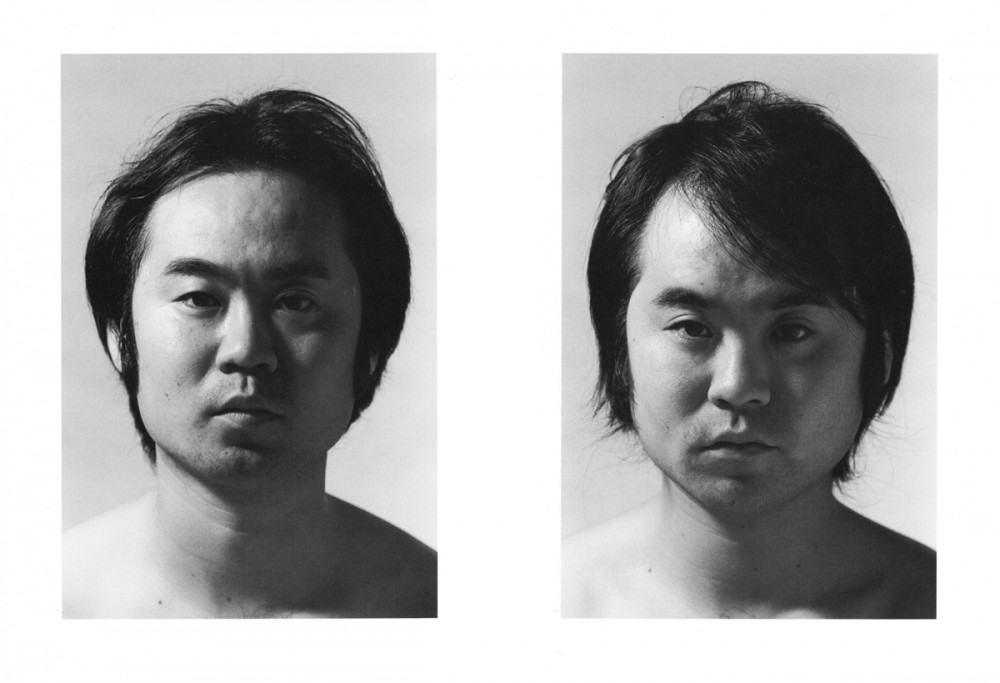 DZ dizygotic twins
